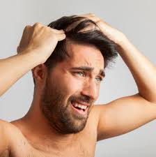 Pérdida de cabello debido a una infección por hongos