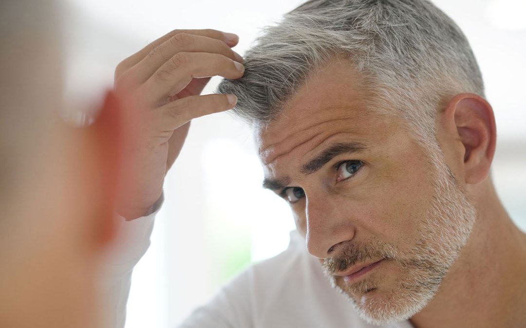 Recuperación tras el Implante Capilar: Cuidado de tu Cabello, Cuida de Ti