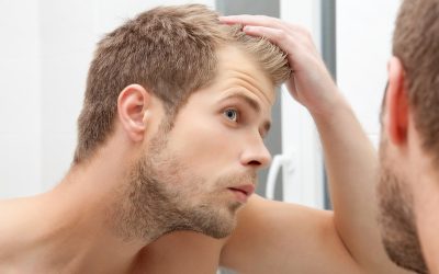 Prevenir la Caspa: Consejos Efectivos para un Cuero Cabelludo Saludable