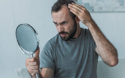 Cómo Identificar la Caída Capilar Excesiva