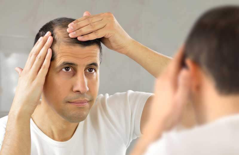 pérdida de cabello