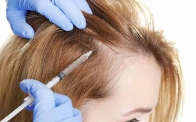 Mesoterapia capilar: ¿para quién está indicada y qué resultados se pueden esperar?